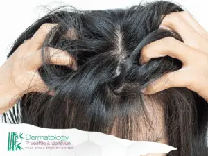 Person scratching scalp with both hands, revealing thinning hair.