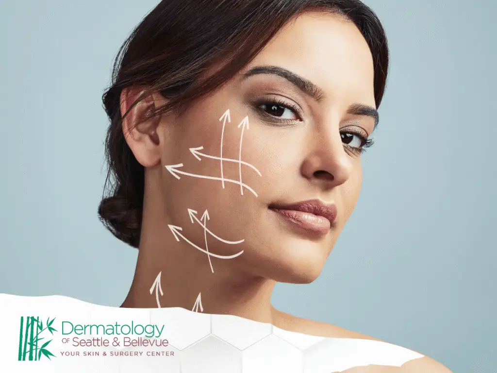 Woman with facial lifting arrows drawn on cheek and jawline.