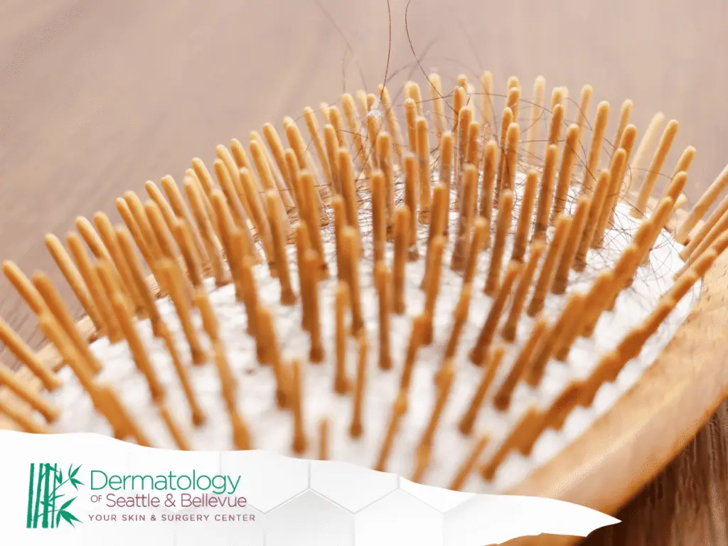 Wooden hairbrush with hair loss strands,