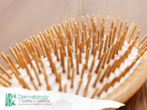 Wooden hairbrush with hair loss strands,