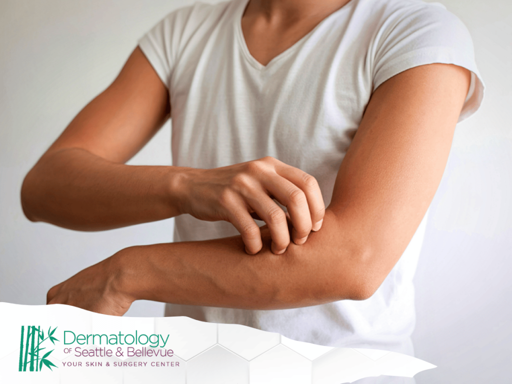 Person in a white shirt scratching their arm.