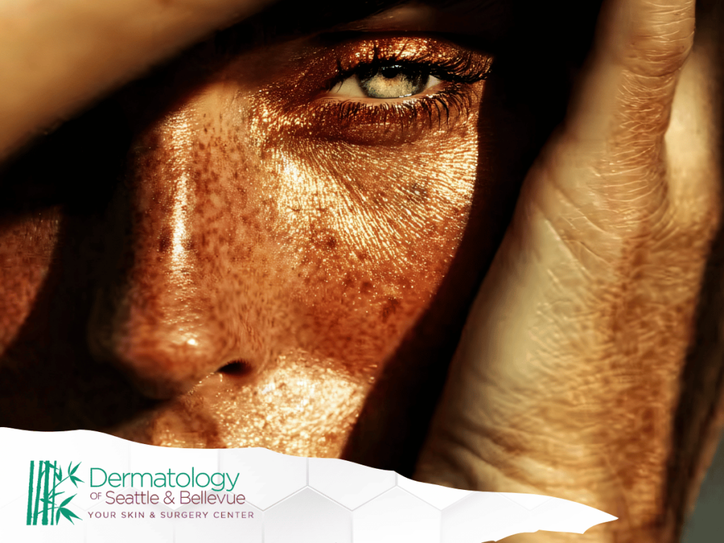 Close-up of a woman's face with freckles and glowing skin.