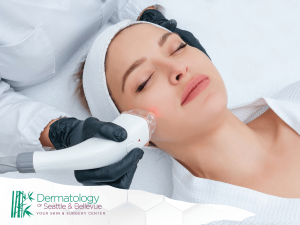 Woman receiving laser treatment on her cheek in a spa setting.