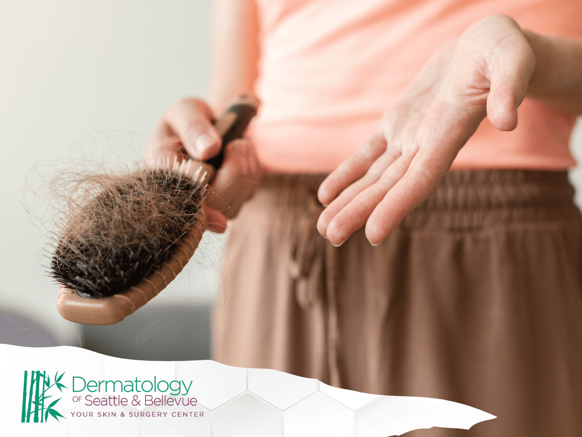 Woman holding a hairbrush with hair strands, palm open.