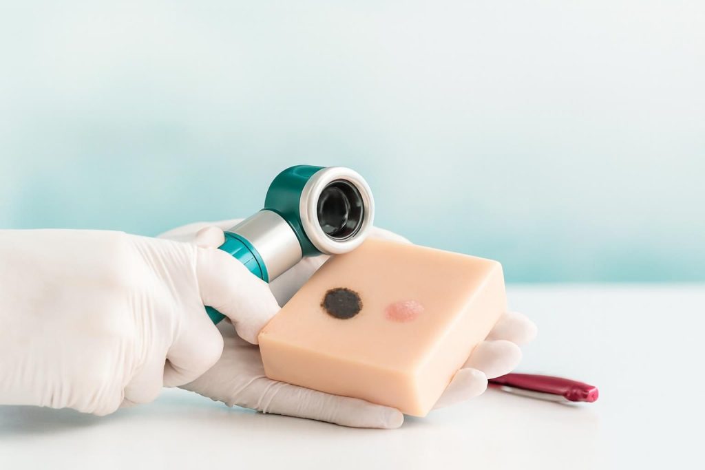 Hand holding a dermatoscope inspecting a soap bar with dark and pink spots.