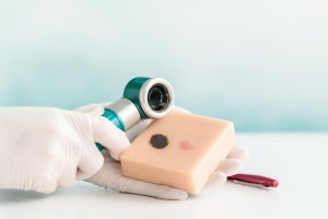 Hand holding a dermatoscope inspecting a soap bar with dark and pink spots.