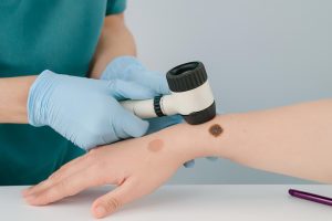 Medical professional examining a skin lesion with a dermatoscope on a patient's arm.